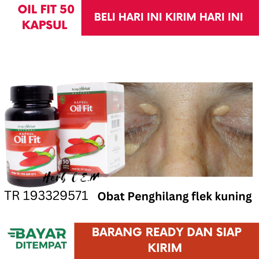 Jual Obat Penghilang Gumpalan Lemak Di Kelopak Mata Obat Xanthelasma ...