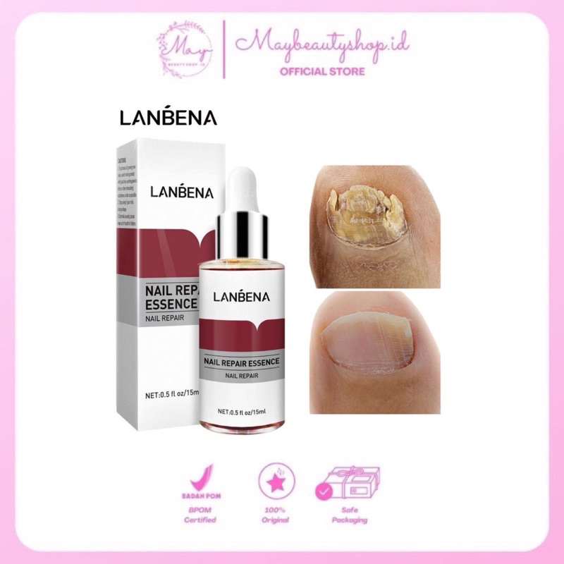 Jual Lanbena Nail Repair Serum (Serum Kuku) Shopee Indonesia