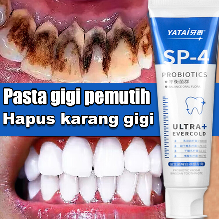 Jual Pasta Gigi Pemutih penghilang karang gigi memutihkan gigi pasta