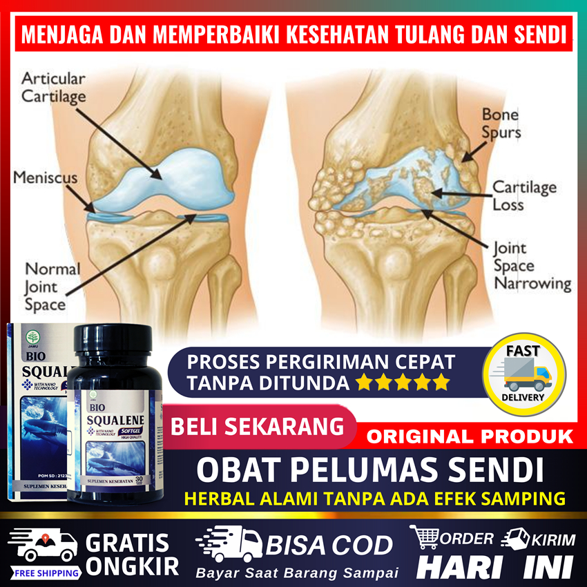 Jual Obat Nyeri Sendi Dan Lutut Rematik Nyeri Otot Pengapuran Tulang Pegal Linu Nyeri Persendian 7855