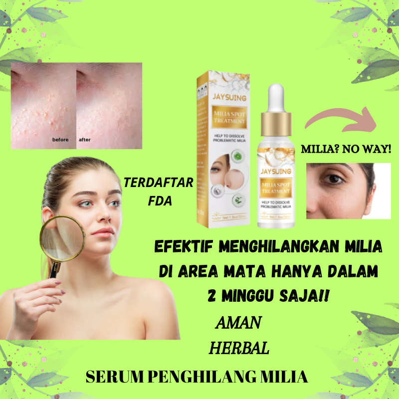 Jual Milia Cream Krim Penghilang Milia Jerawat Bintik Putih di bawah