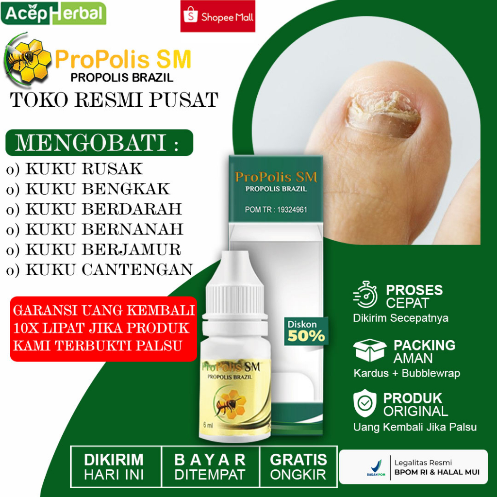 Jual Obat Kuku Jamur Dan Rusak Cantengan Jempol Kaki Bengkak Bernanah