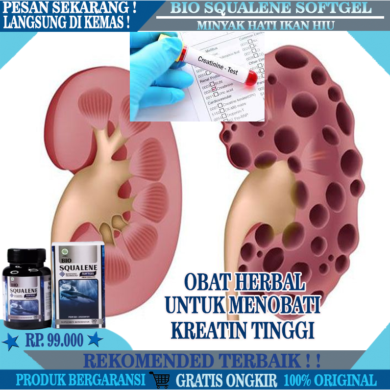 Jual Obat Penurun Kreatinin & Ureum Tinggi, Menurunkan Kadar Ureum