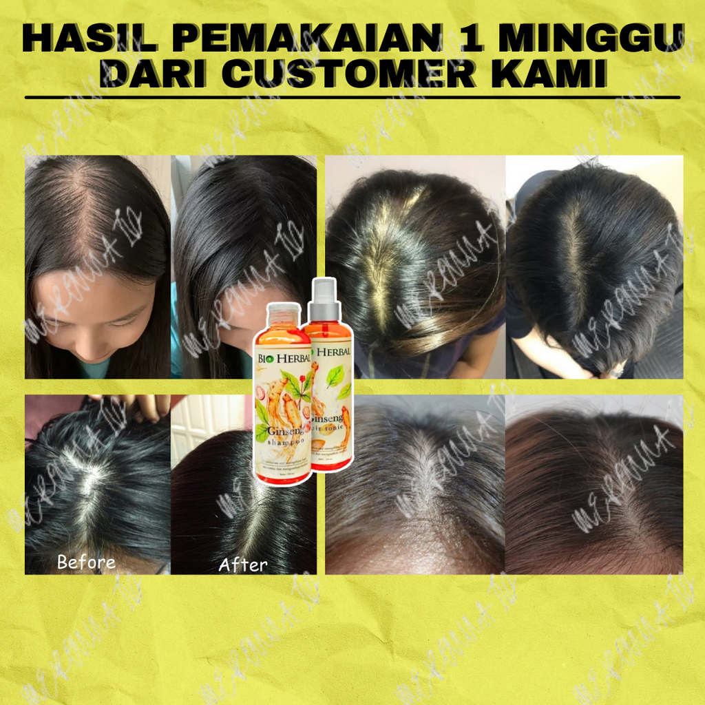 Jual PAKET 2 IN 1 RAMBUT RONTOK - PENUMBUH RAMBUT - PENGUAT RAMBUT ...