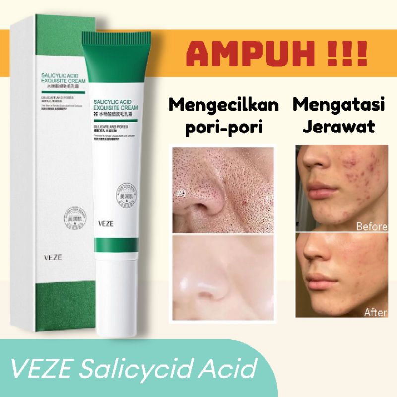 Jual Cindynal Salicycidacid Krim Penghalus Pori Pori Atasi Jerawat Kontrol Minyak Anti Penuan 1415