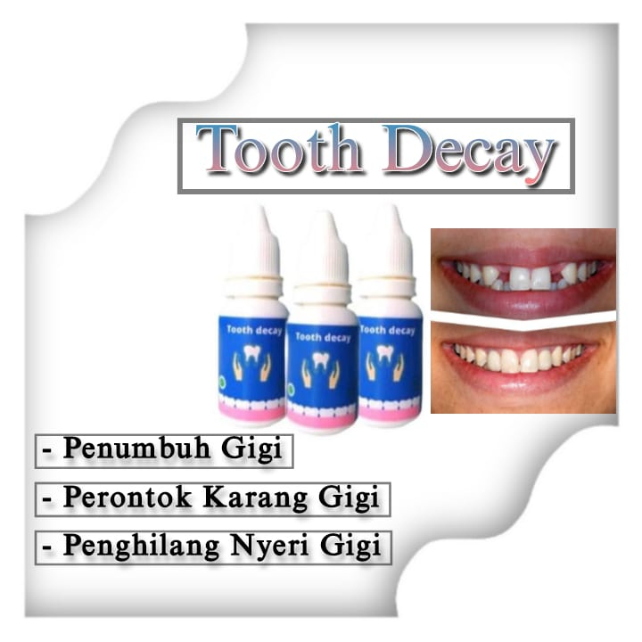 Jual Tooth decay penumbuh gigi dewasa solusi gigi ompong gigi kropos