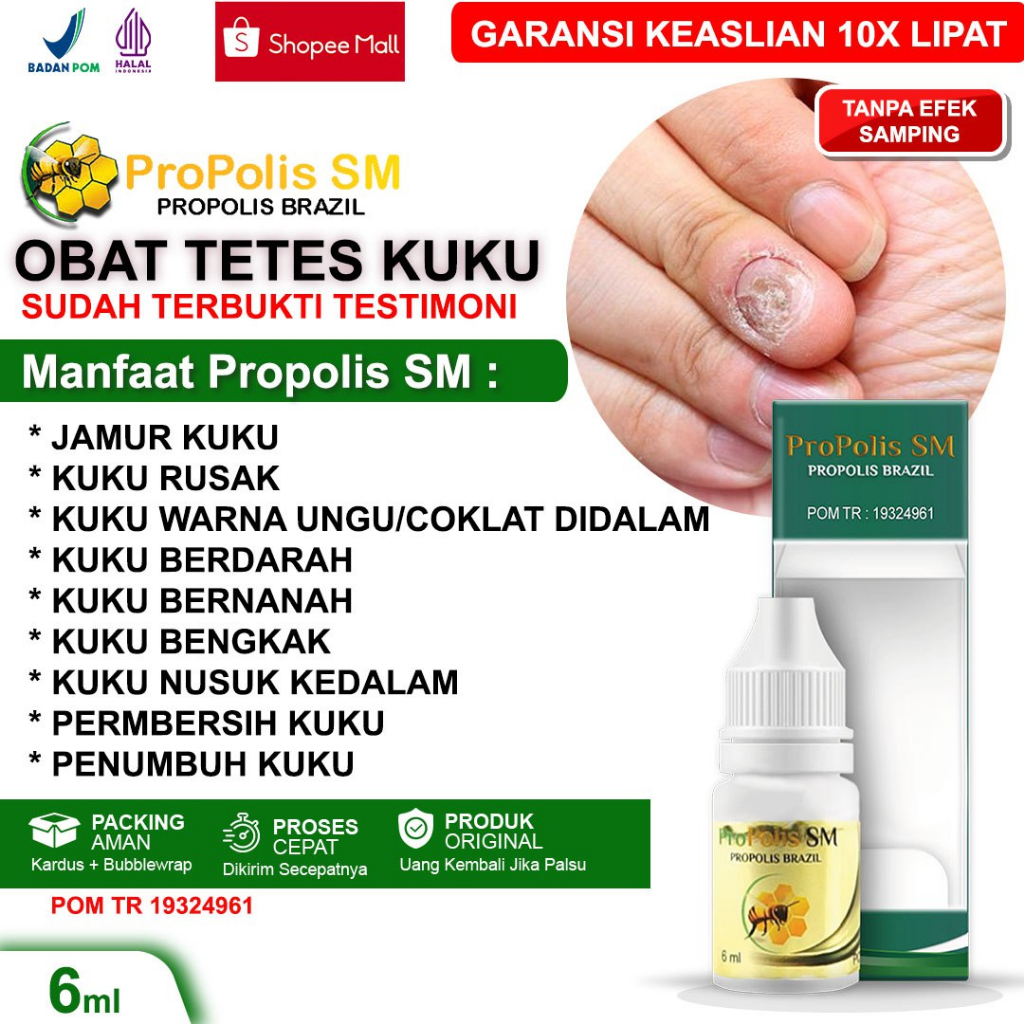 Jual Obat Kuku Jamur Obat Kuku Rusak Tangan Kaki Kuku Kuning Cantengan