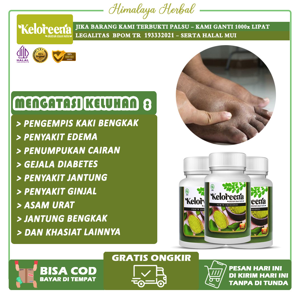 Jual Obat Kaki Bengkak Karena Gula Diabetes Asam Urat Gula Darah Tinggi