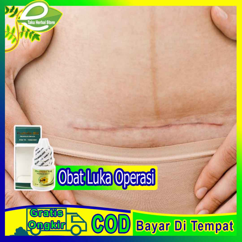 Jual Obat Luka Operasi, Obat Pengering Luka, Obat Pengering Luka ...