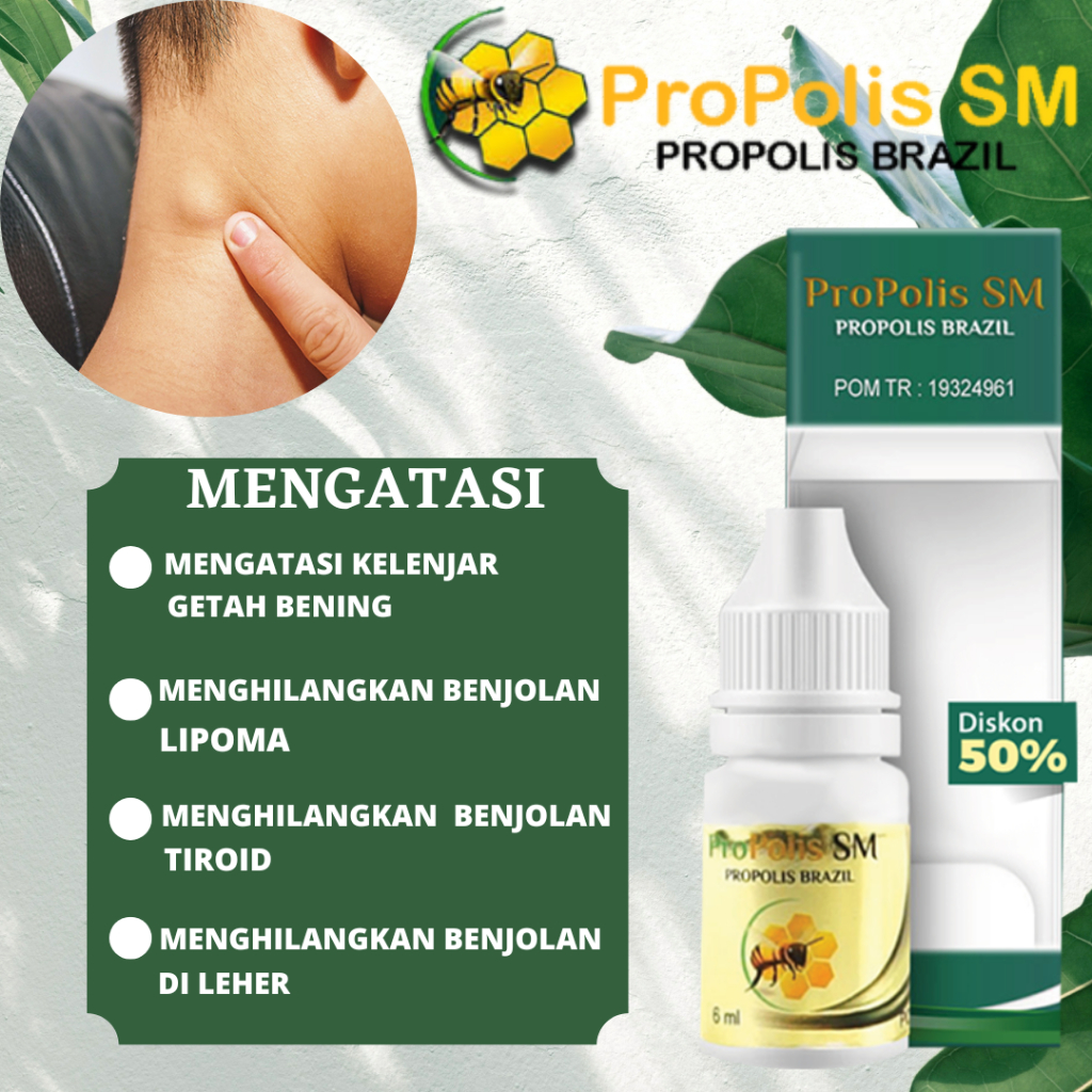 Jual Obat Benjolan Lipoma, Obat Benjolan Di Leher, Obat Benjolan Tiroid ...