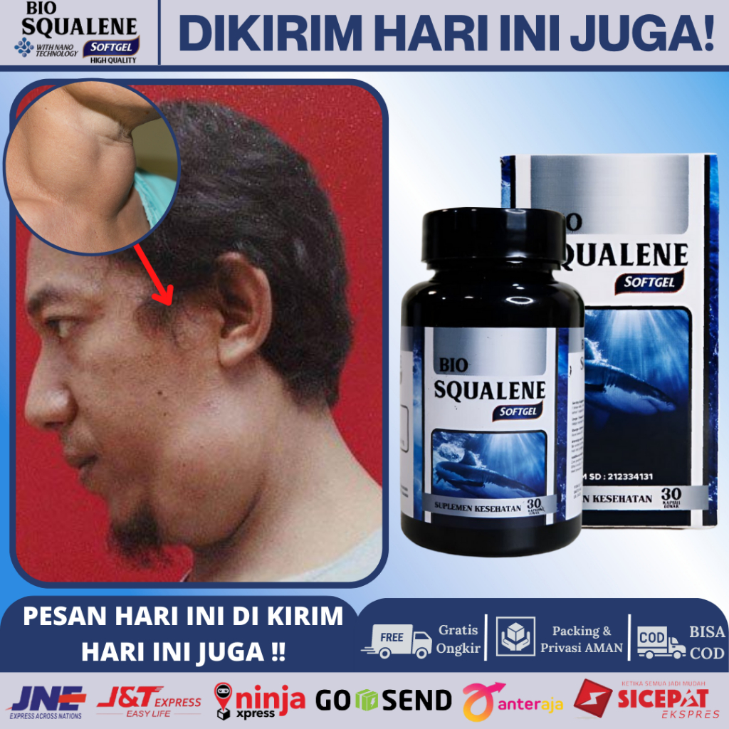 Jual Obat Benjolan Di Leher Kelenjar Getah Bening Penghancur Benjolan