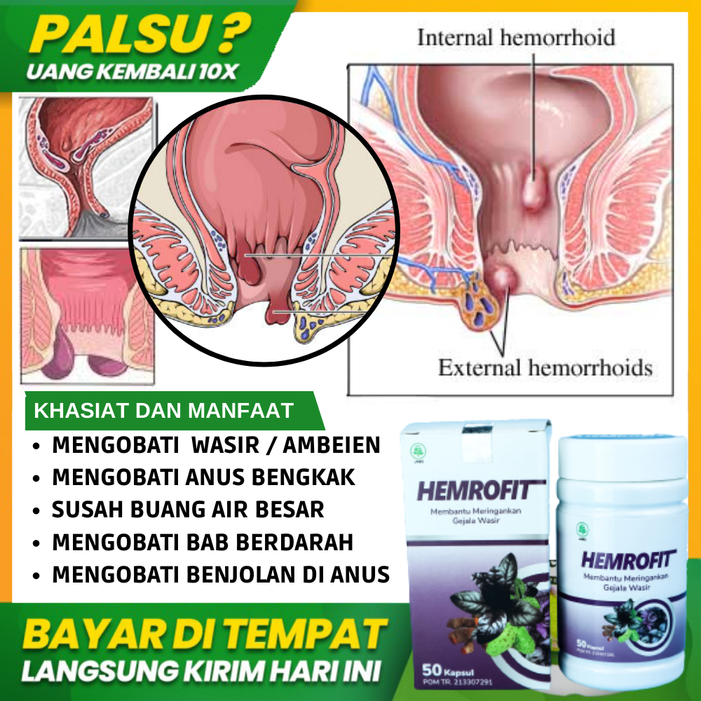 Jual Obat Ambeien Wasir Stadium 1 2 3 4 Benjolan Pada Anus Bab Berdarah