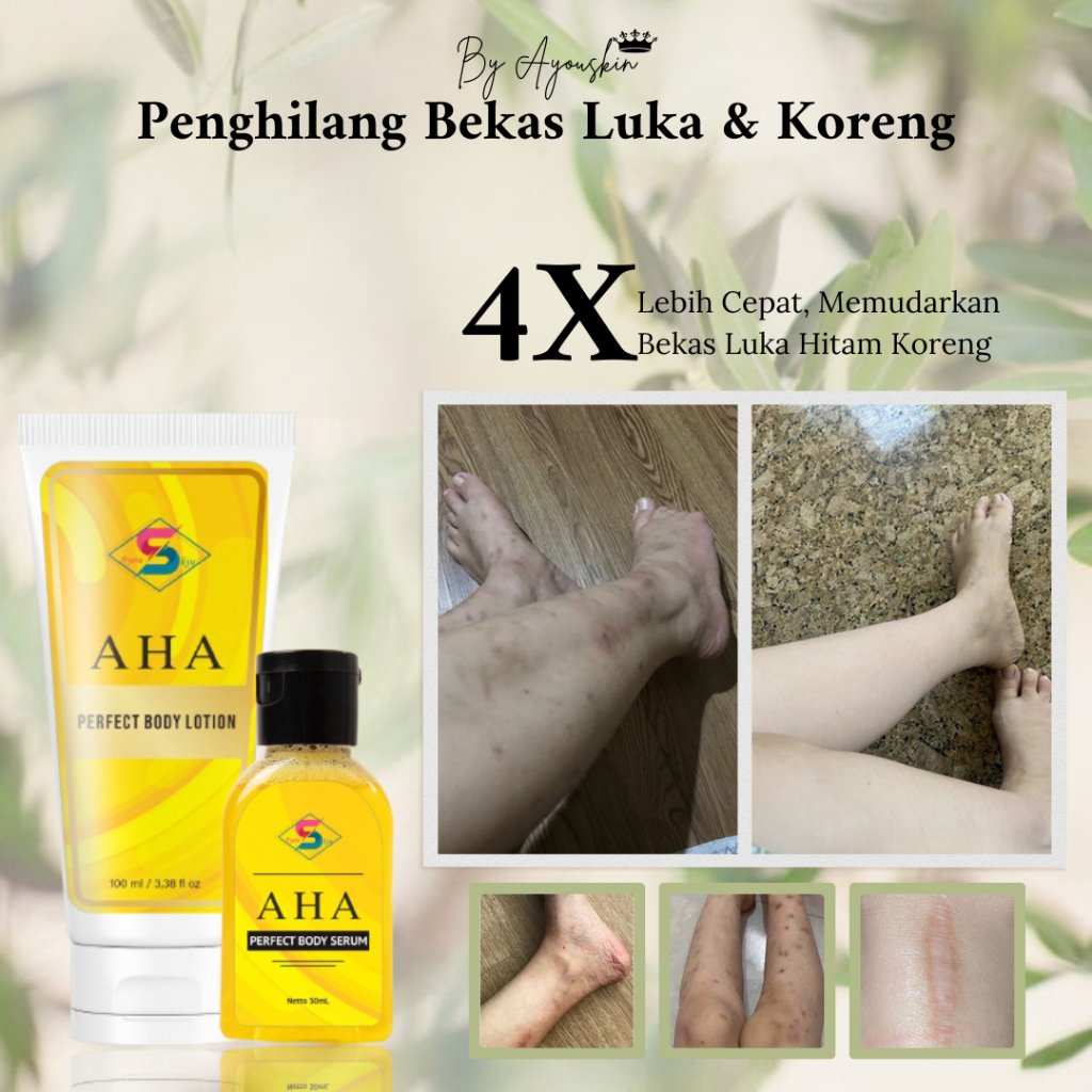Jual Ayouskin Body Lotion Penghilang Bekas Luka / Menghilangkan Bekas