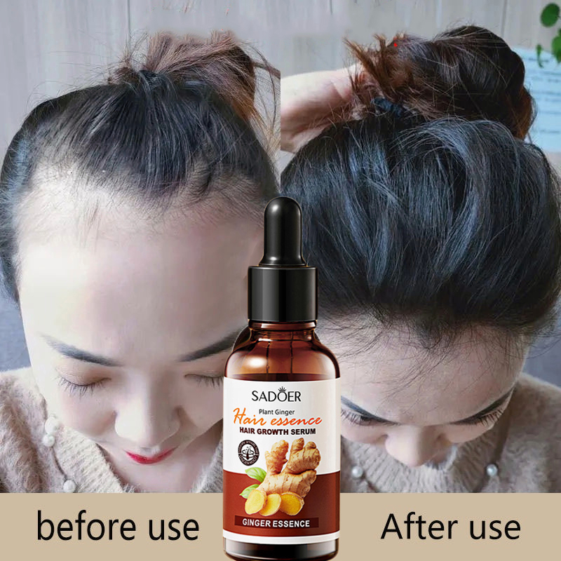 Jual rambut penumbuh rambut botak Penebal rambut penumbuh rambut cepat ...