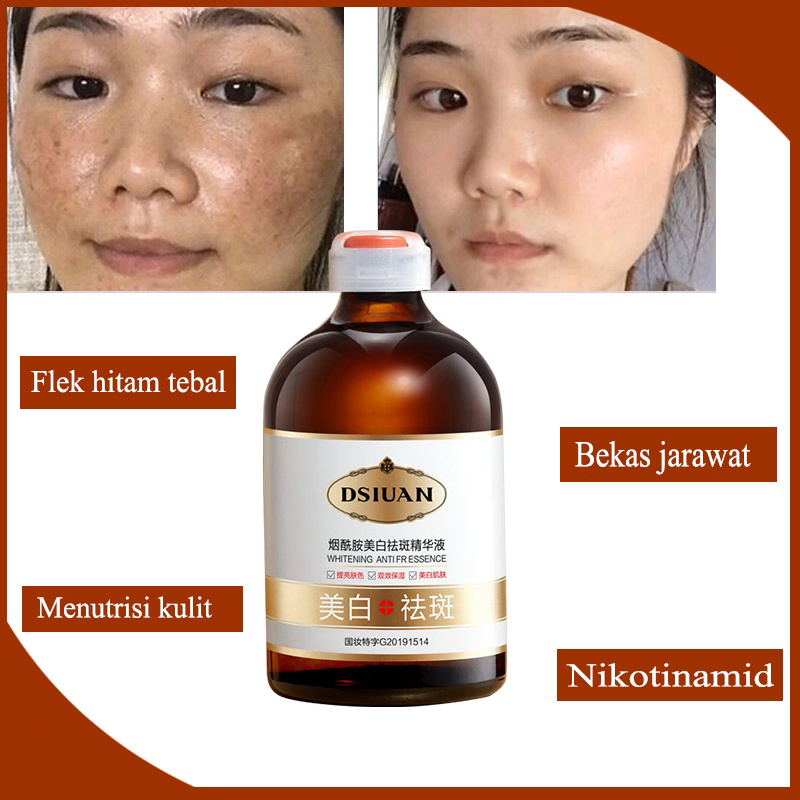 Jual Penghilang Flek Serum Pemutih Wajah Serum Melasma Serum Flek Hitam Membandel G