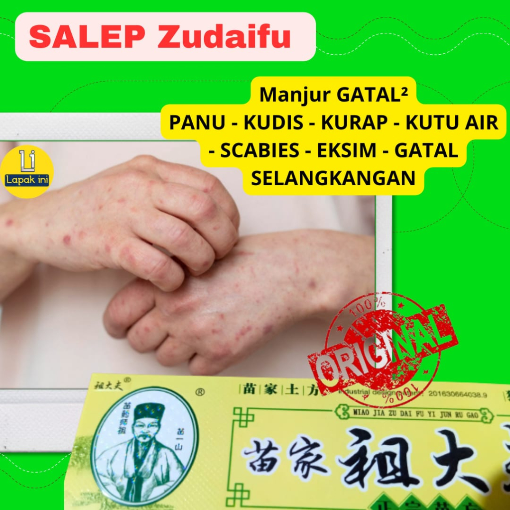 Jual Salep Kulit Zudaifu Gatal Eksim Original Alergi Gatal Shopee