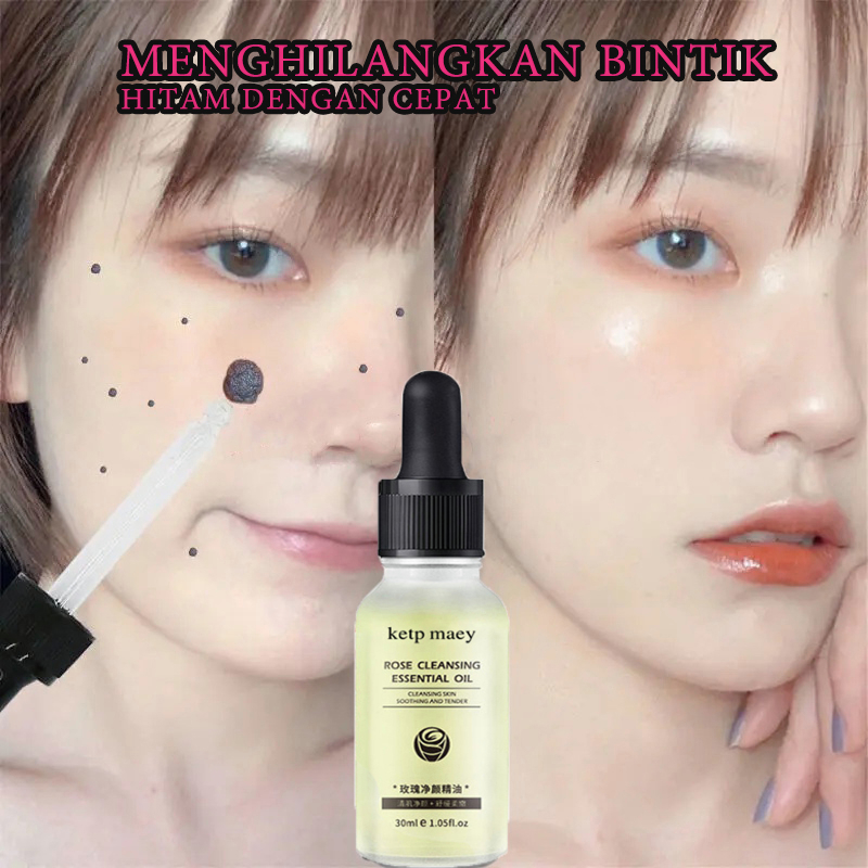 Jual Penghilang Tahi Lalat Penghilang Kutil Skin Tag Remover Tahi Lalat ...