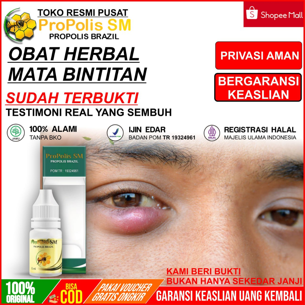 Jual Obat Benjolan Kalazion Obat Benjolan Di Dekat Mata Obat Bintitan ...