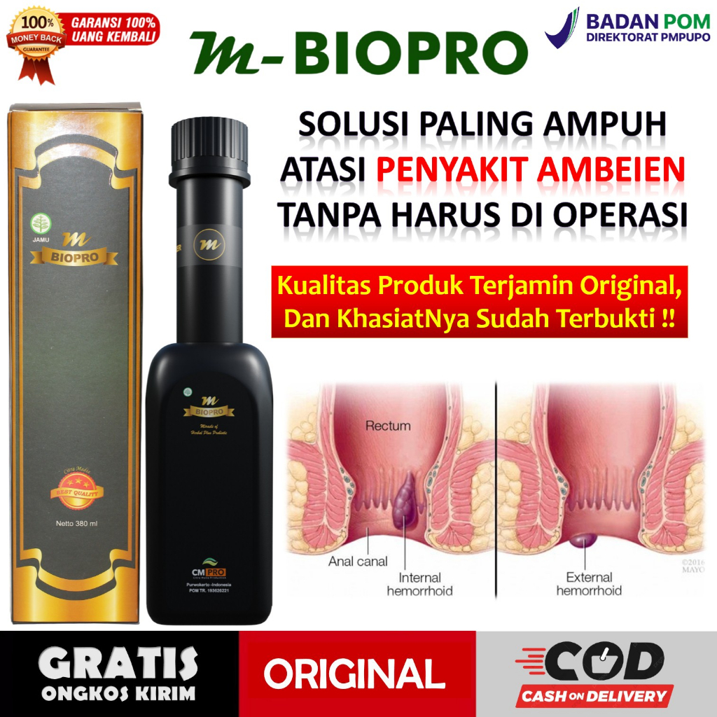 Obat Ambeien Paling Ampuh - Obat Ambeien Dan Wasir - Obat Susah Bab - Mbiopro Original Terpercaya
