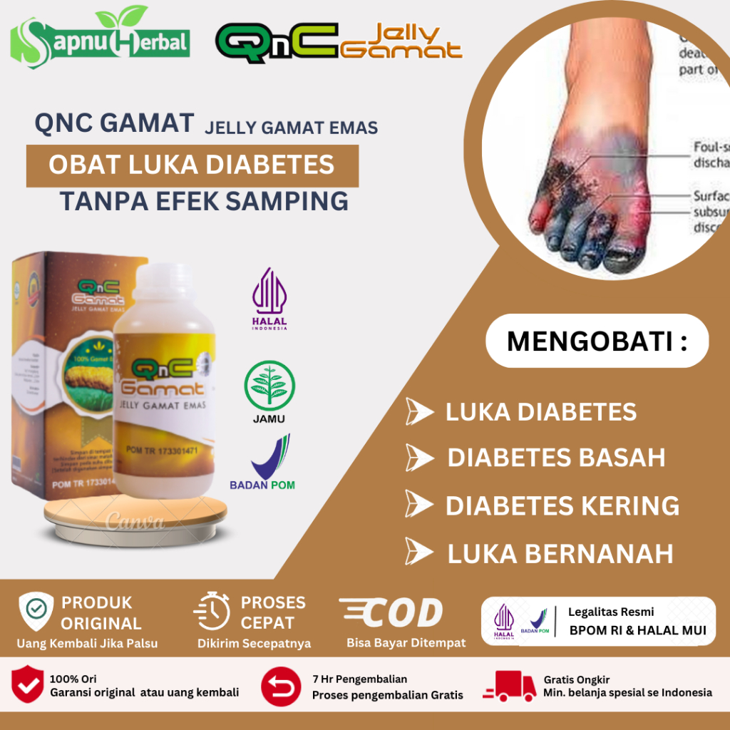 Jual Sapnu Herbal Obat Luka Diabetes Melitus Basah Kering Bernanah