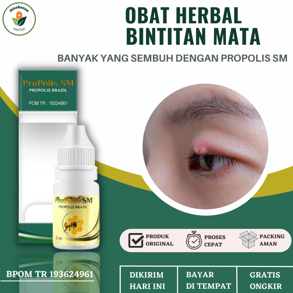 Jual Obat Bintitan - Benjolan Di Atas Kelopak Mata - Kalazion Propolis ...