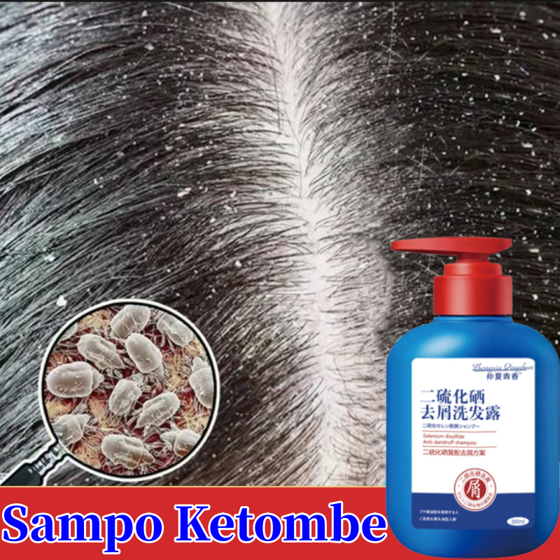 Jual Shampo Anti Ketombe Selenium Sulfide Shampoo Anti Tungau Anti