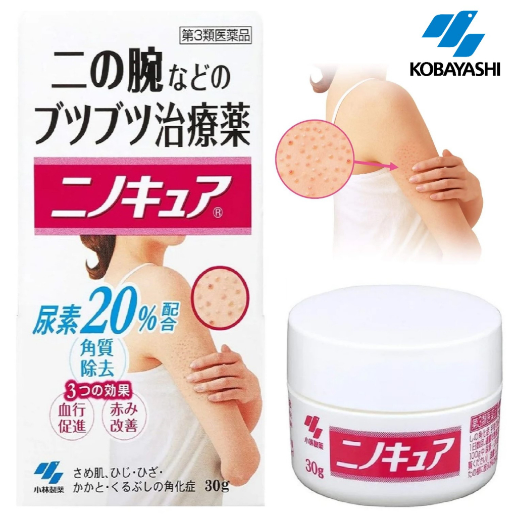 Jual KOBAYASHI Nino Cure Medicated Cream for Keratosis Pilaris 30g