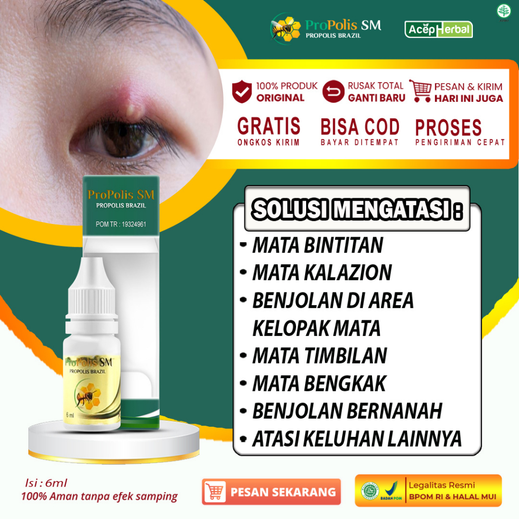 Jual Obat Oles Mata Bintitan Kalazion Mata Timbilan Bernanah Mata ...