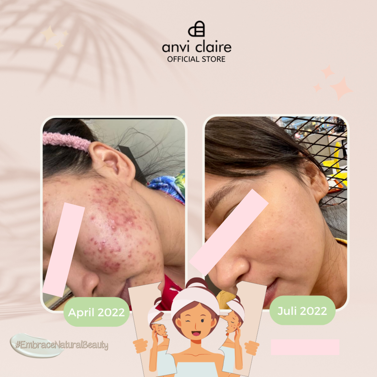 Jual ANVI CLAIRE Dear C Clear Glow Serum Acne Care Vitamin C | Shopee ...