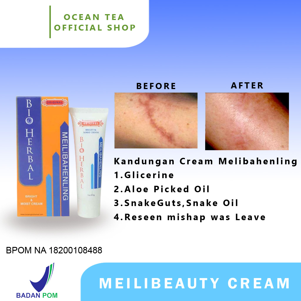 Jual Cream Penghilang Bekas Luka Hitam Jerawat Koreng Dan Keloid Salep