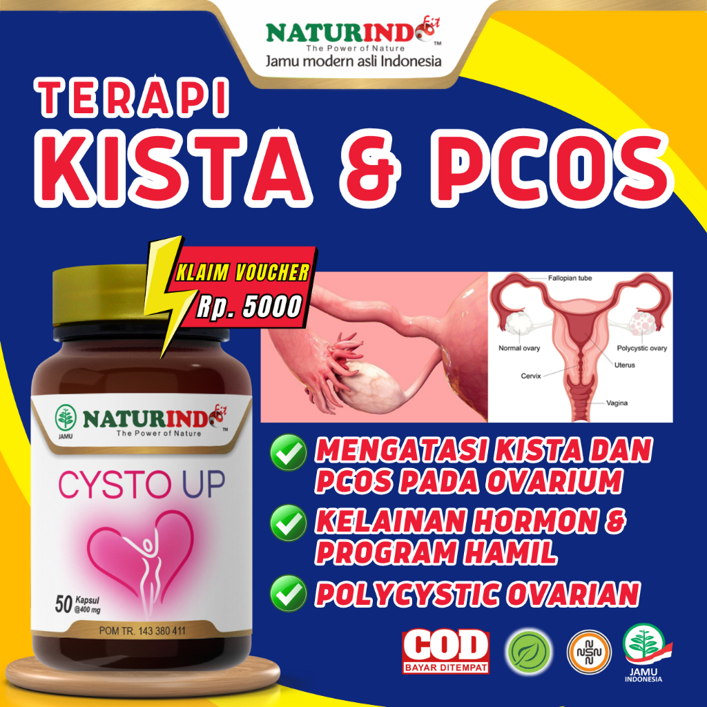 Jual Obat Herbal Kista Pcos Sindrom Ovarium Polikistik Ovarium Sel