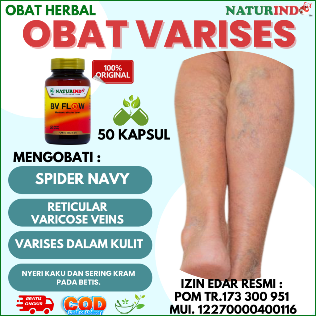 Jual Obat Varises Paling Ampuh Herbal Otot Kaki Bengkak Farises Di Betis Dan Kaki Pelancar 4285