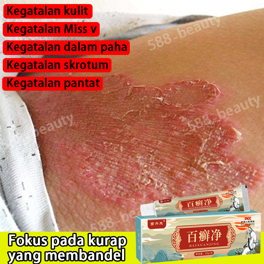 Jual Obat Gatal Selangkangan Obat Kurap Selangkangan Hitam Eksim Dan