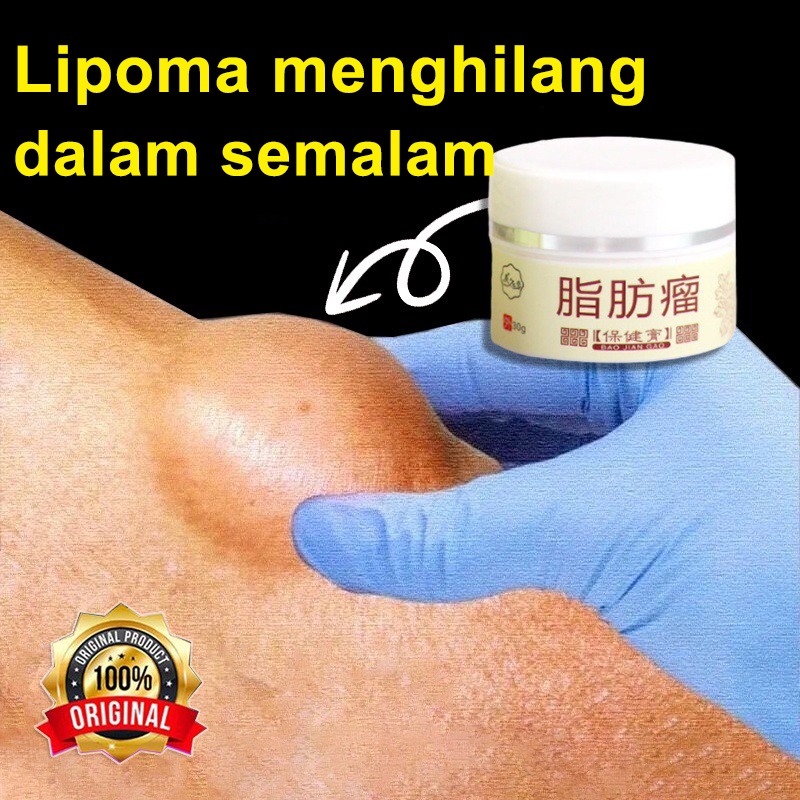 Jual Obat Kista Ganglion, Obat Benjolan Lipoma, Obat Benjolan Di Tangan ...