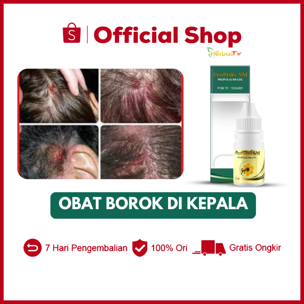 Jual Propolis Sm Obat Tetes Kepala Borok Kepala Korengan Kepala