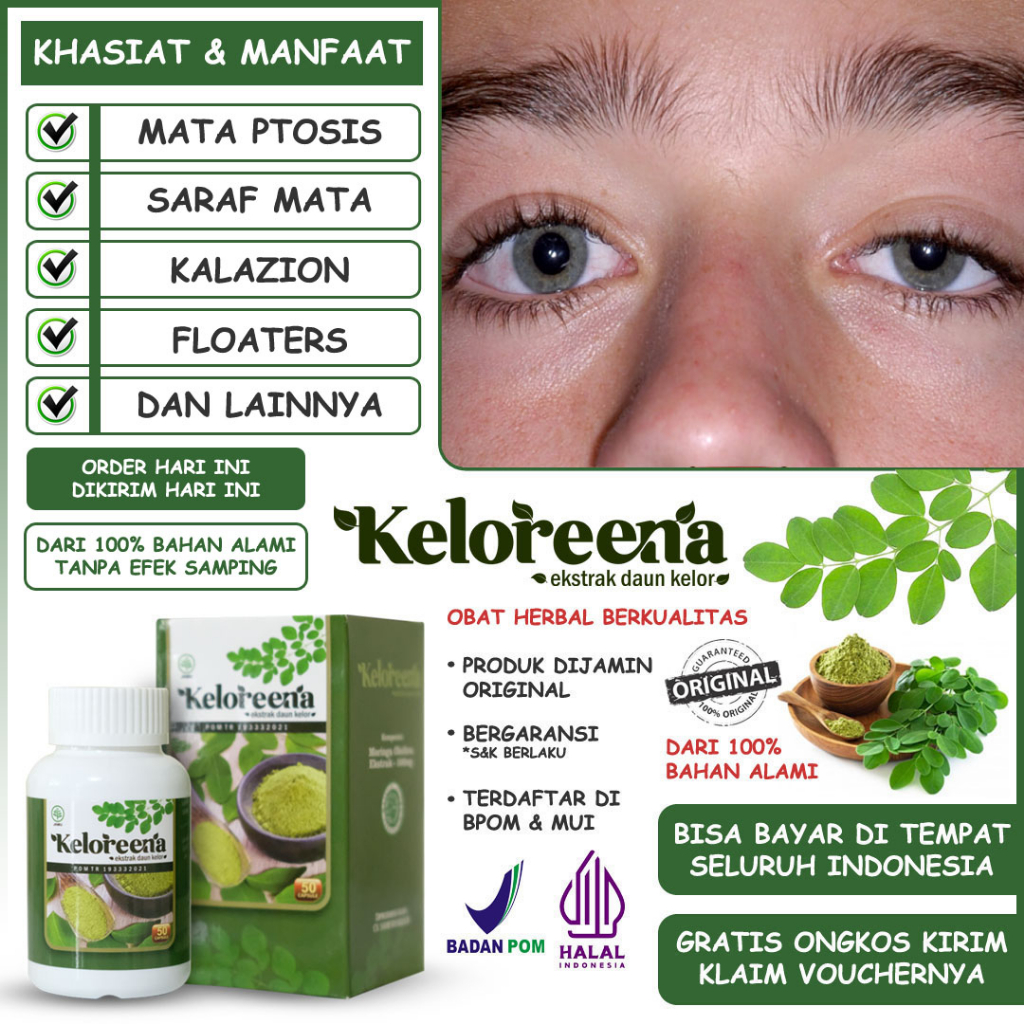 Jual Obat Mata Ptosis Kelopak Mata Malas Turun Sipit Sebelah Bengkak