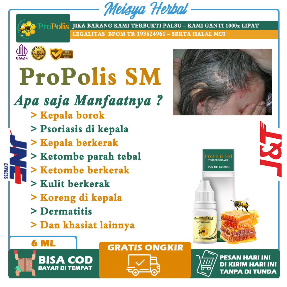 Jual Obat Borok Di Kepala Kulit Kepala Kering Bersisik Gatal Kulit