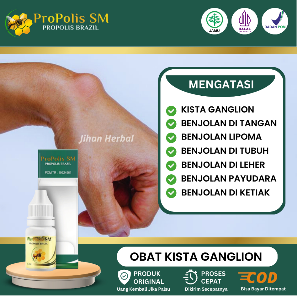 Jual Obat Kista Ganglion Lipoma Benjolan Di Tangan Leher Payudara