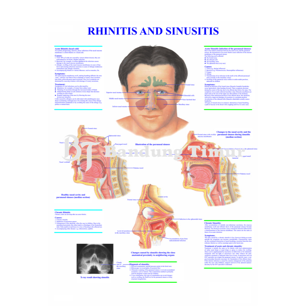 Jual POSTER ANATOMI HIDUNG - RHINITIS AND SINUSITIS | Shopee Indonesia