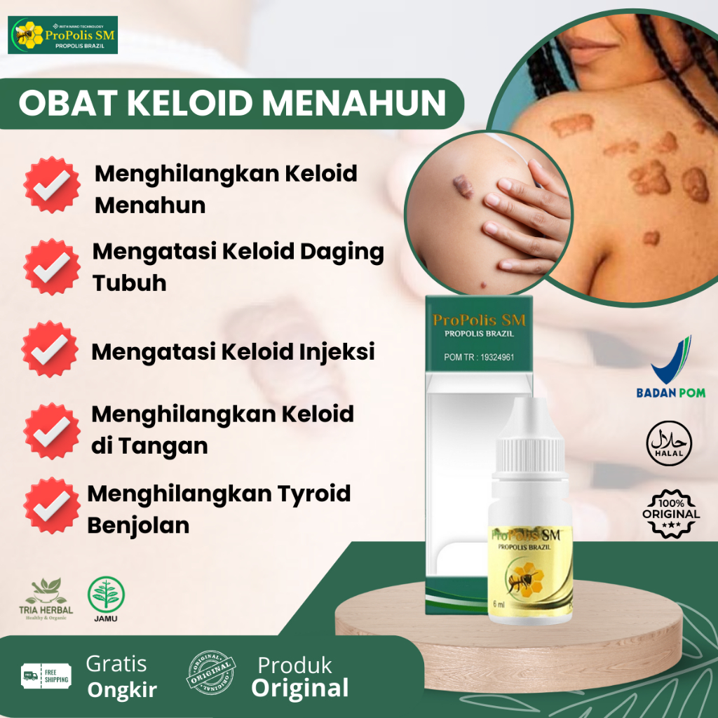 Jual Obat Keloid Menonjol Tahunan Keloid Daging Tumbuh Penghilang Keloid Berkerut Keloid Di 4702