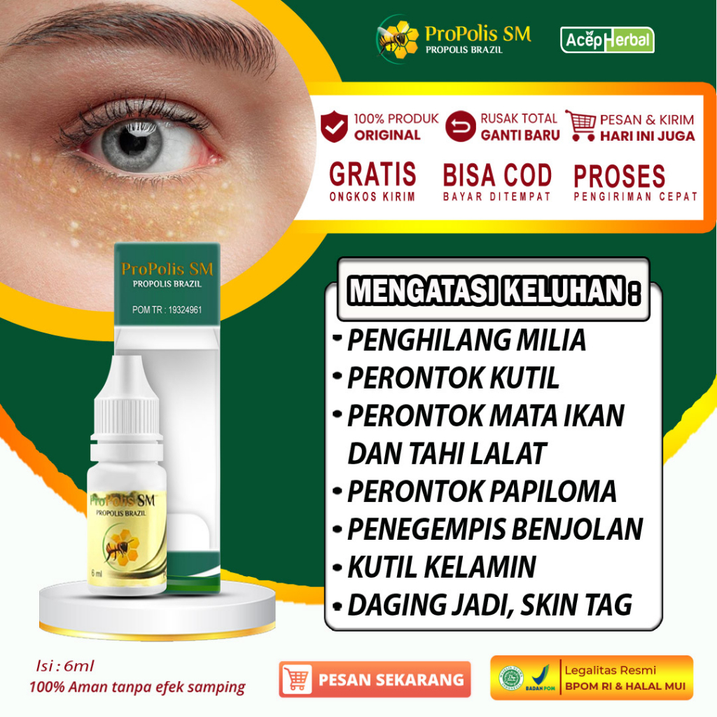 Jual Obat Milia Di Bawah Mata Penghilang Bintik Putih Di Bawah Kelopak Mata Beruntusan Di Wajah