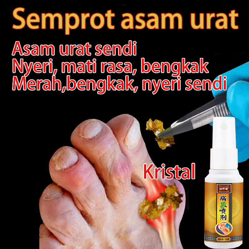 Jual Obat Asam Urat Rematik Radang Sendi Herbal 30ml Semprotan Rematik Pereda Nyeri Pada Sendi 4628