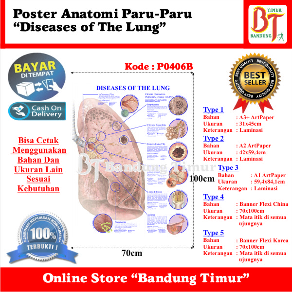 Jual POSTER ANATOMI PARU-PARU - DISEASES OF THE LUNG | Shopee Indonesia