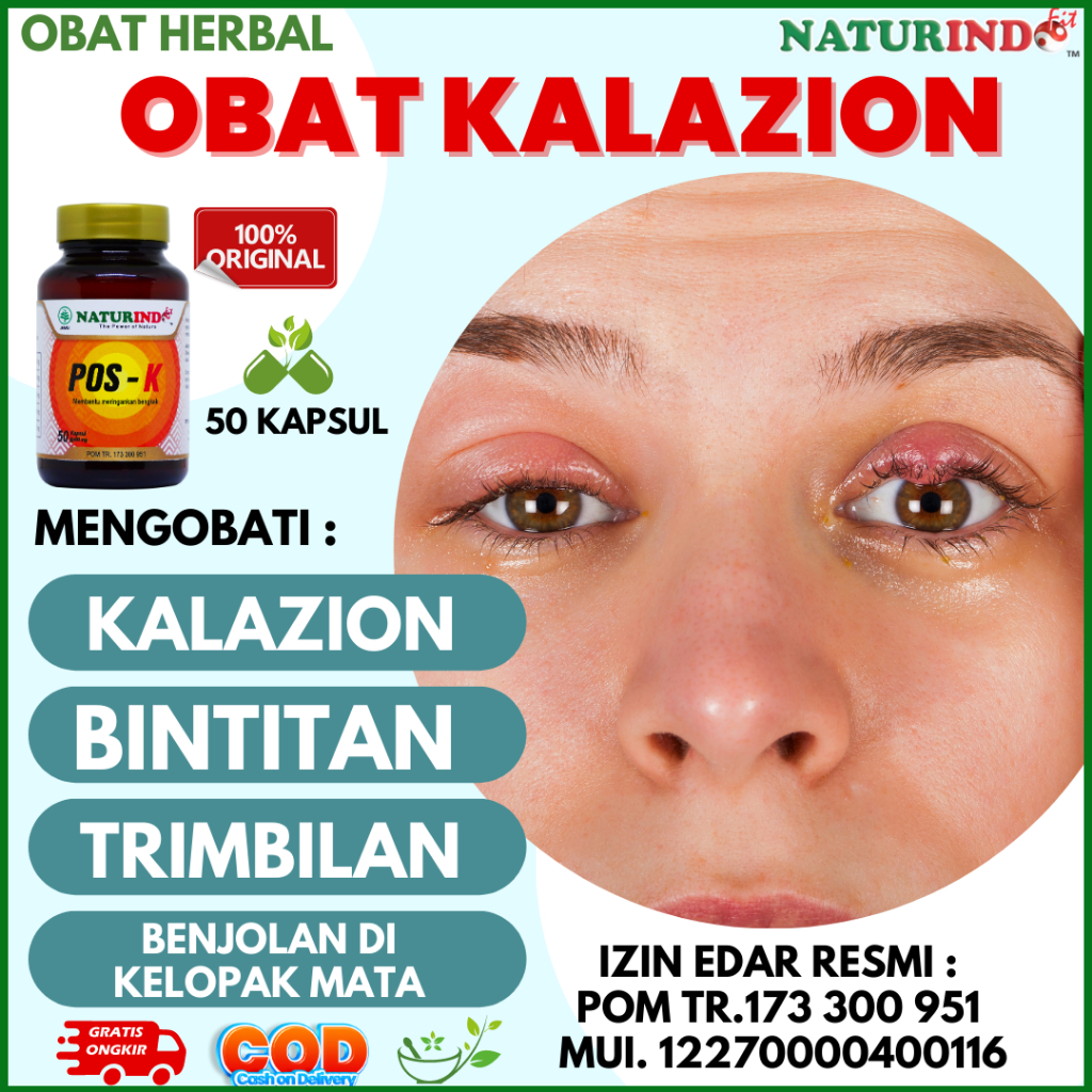 Jual Obat Kalazion Bintitan Benjolan Di Kelopak Mata Shopee Indonesia