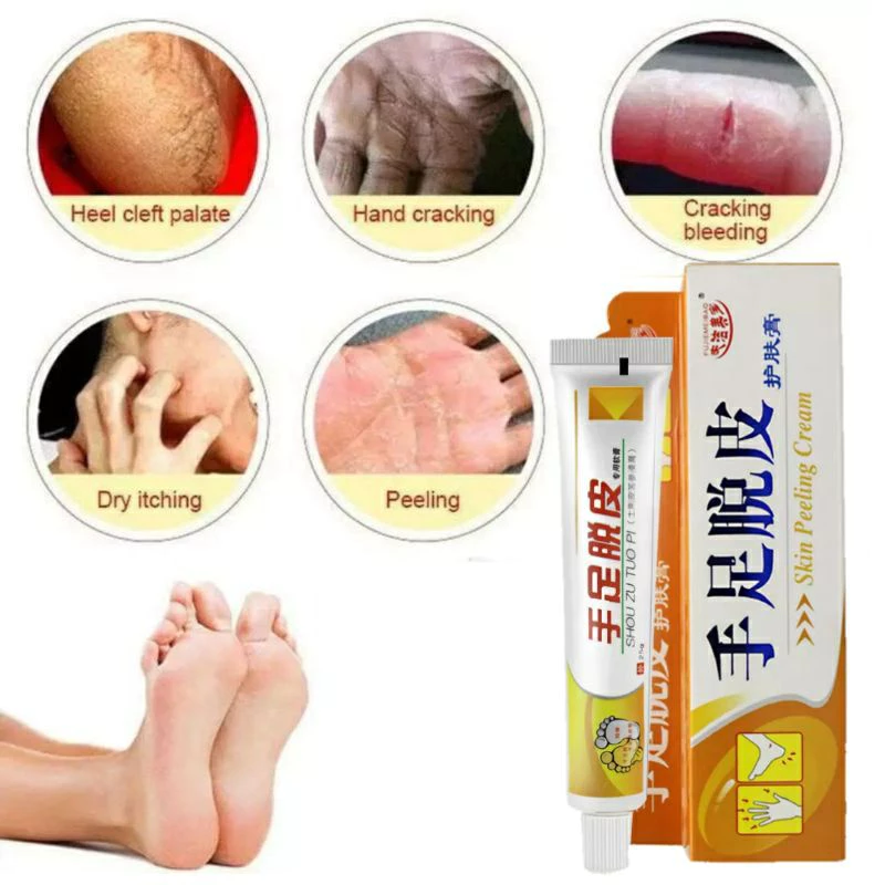 Hope Store - Salep Tumit Skin Peeling Cream Ampuh Mengobati Kaki Pecah Pecah dan Kering | AutoStock