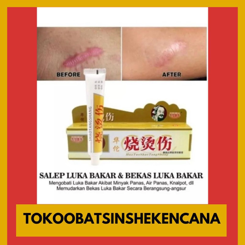 Jual Salep Huatuo Shao Tang Shang Original Salep Luka Bakar Keloid