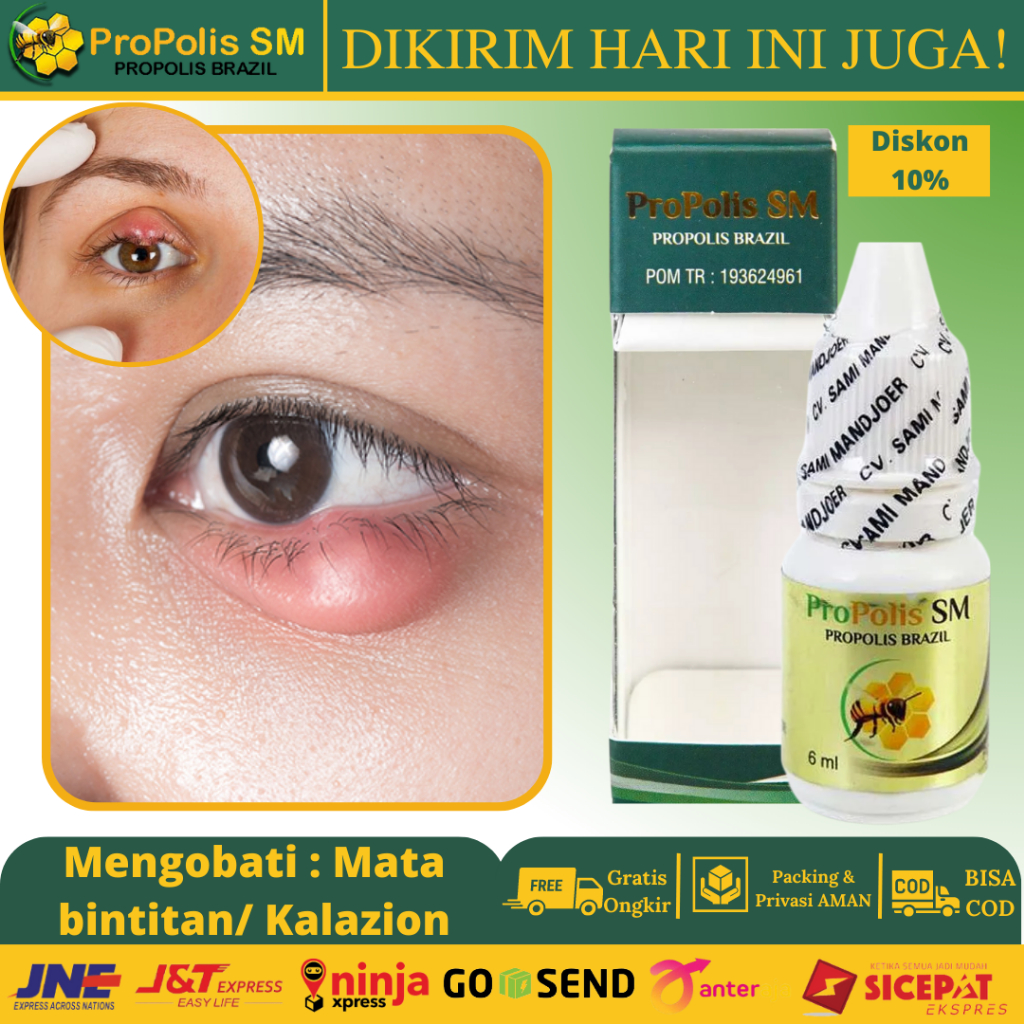 Jual Propolis Sm Obat Mata Bintitan, Kalazion, Benjolan Di Mata, Obat ...