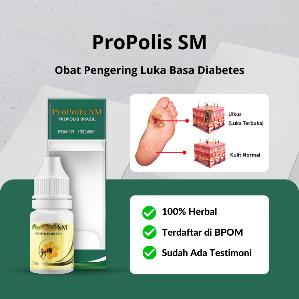 Jual Propolis Sm Obat Pengering Luka Basah Bernanah Luka Diabetes