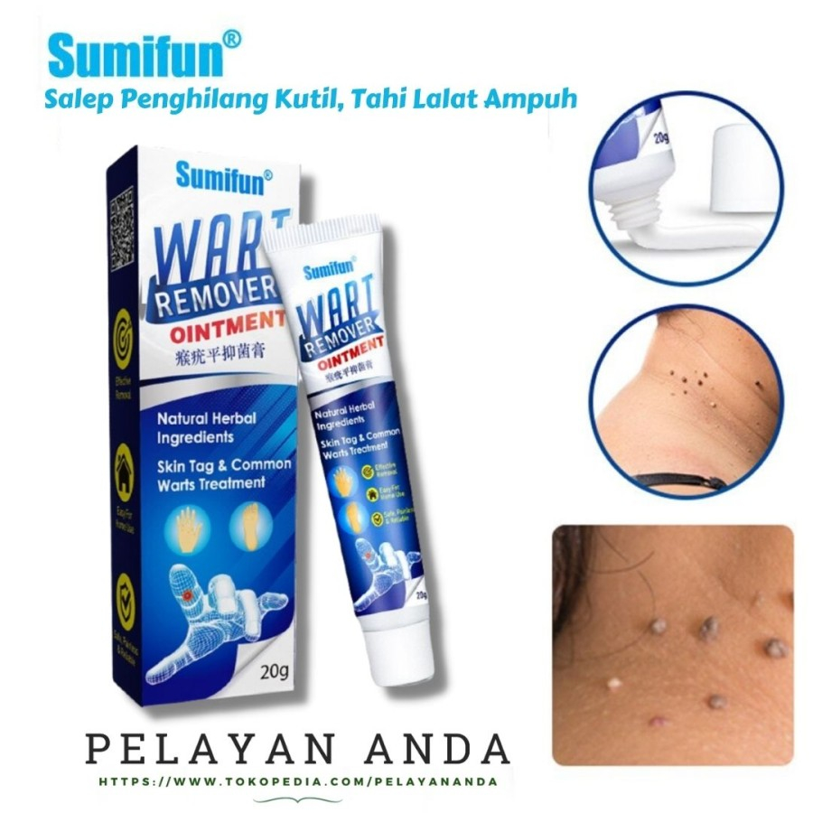 Jual Salep Obat Penghilang Kutil Paling Ampuh Sumifun Wart Remover ...