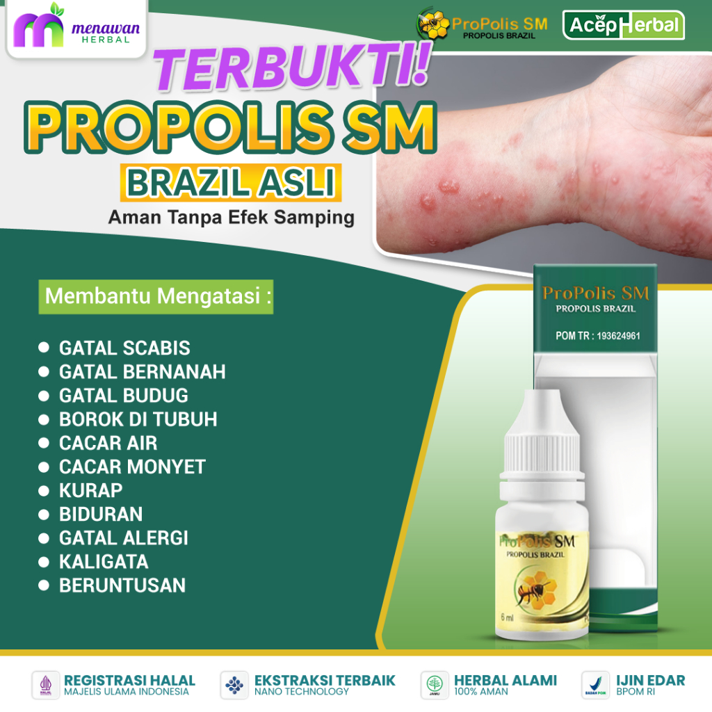 Jual Obat Gatal Di Kulit Gatal Scabies Gatal Bernanah Gatal Alergi ...